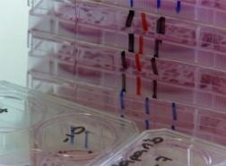 Breakthrough Breast Cancer Research Centre